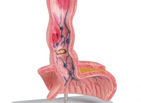https://jayakelana.id.202-10-43-6.cpanel.site/uploads/product/-k218-oesophagus-diseases-91822f04ad01eaf_cover.jpg