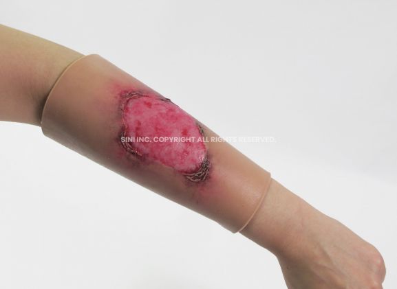 https://jayakelana.id.202-10-43-6.cpanel.site/uploads/product/-l-bur-01-burn-treatment-model-30229ee7a54c9c5_cover.jpg