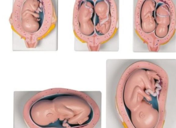 https://jayakelana.id.202-10-43-6.cpanel.site/uploads/product/-l204-pregnancy-model-set--3240079c3983ebe_cover.jpg