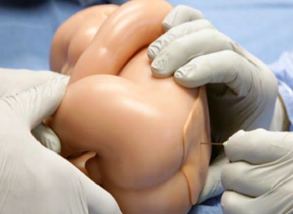 https://jayakelana.id.202-10-43-6.cpanel.site/uploads/product/-lpb-40-lumbar-puncture-baby-752626142266041_cover.png