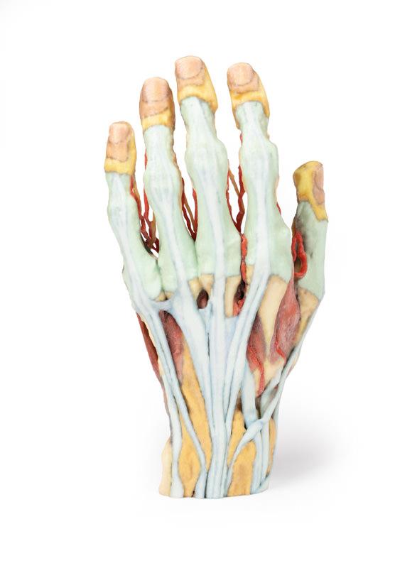 (MP1530) Hand