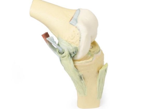 https://jayakelana.id.202-10-43-6.cpanel.site/uploads/product/-mp1800-knee-joint-flexed-89418a7b40730c5_cover.jpg