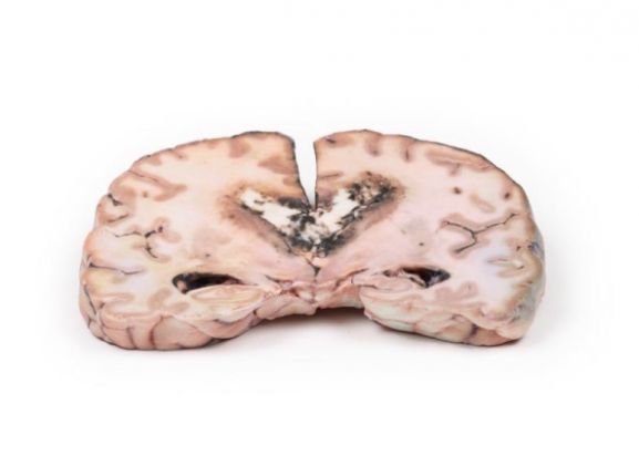 https://jayakelana.id.202-10-43-6.cpanel.site/uploads/product/-mp2003-glioma-grade-3-4--15959f8d55a3304_cover.jpg