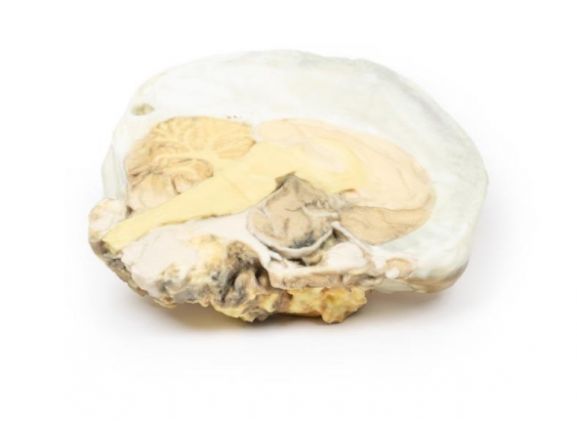 https://jayakelana.id.202-10-43-6.cpanel.site/uploads/product/-mp2006-pituitary-adenoma-24584e7d9ff5b59_cover.jpg