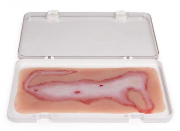 https://jayakelana.id.202-10-43-6.cpanel.site/uploads/product/-nw108-wound-moulage-scalding-878556fa9e7b542_cover.jpg