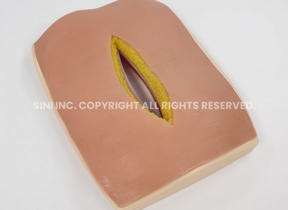https://jayakelana.id.202-10-43-6.cpanel.site/uploads/product/-s-afs-01-abdominal-fascia-suture-968431c7eb30eca_cover.jpg