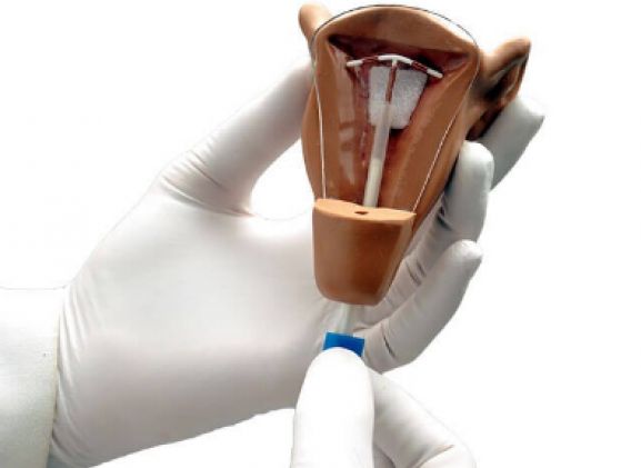 https://jayakelana.id.202-10-43-6.cpanel.site/uploads/product/uterus-i-iud-placement-64463ffb81dc10c_cover.png